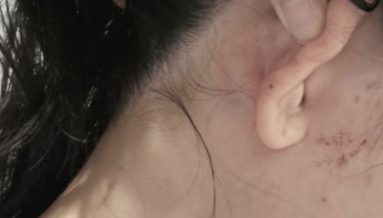 使馆回应中国女子在堪培拉遭陌生人殴打：要求澳警方彻查案件